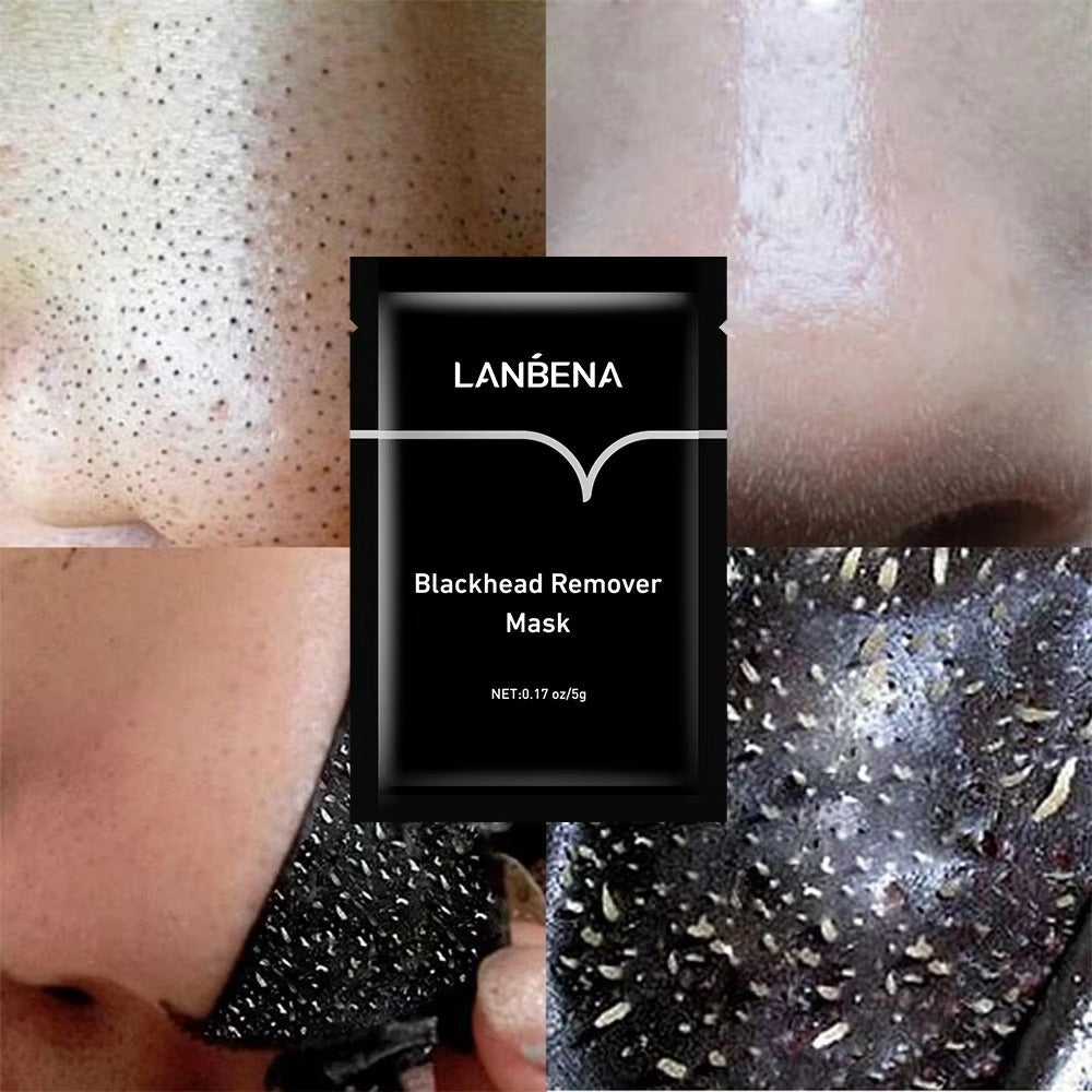 Nose Blackhead Remover